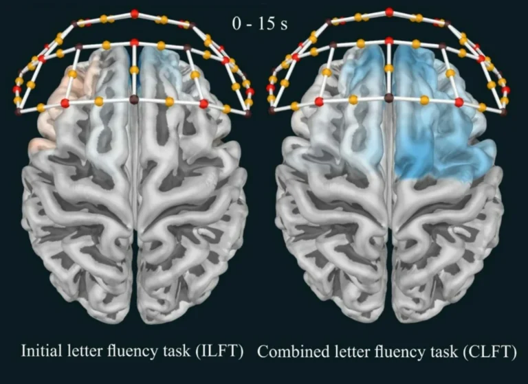 Frontal Cortex Activation During CLFT: A Photon Cap C20 Data Analysis